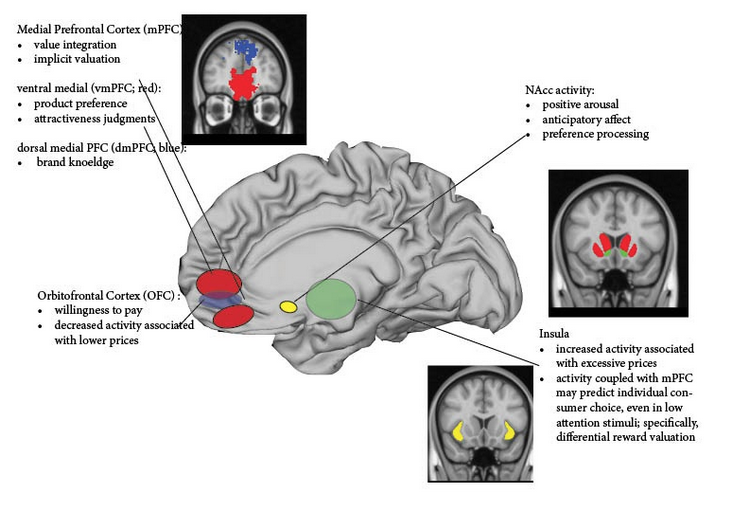 Image of relevant brain areas